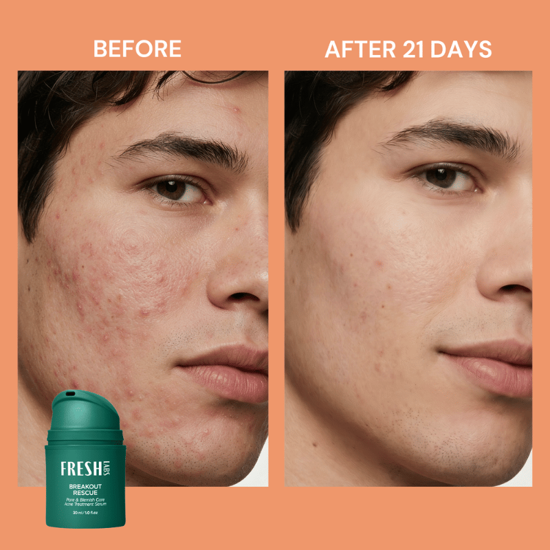 Visible Results in 21 Days