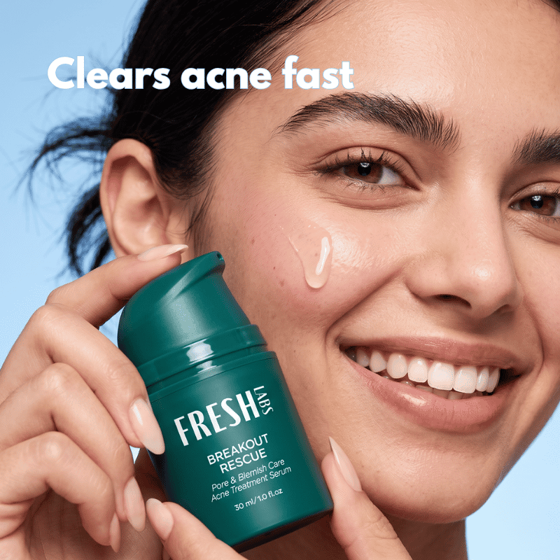 Breakout Rescue Acne Serum